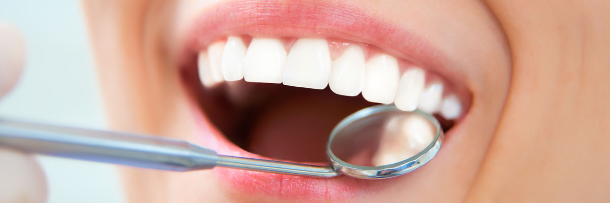 Smile-Aligner Almedico GmbH
